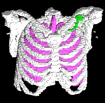 fig2