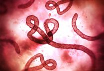 Ebola virus under a microscope