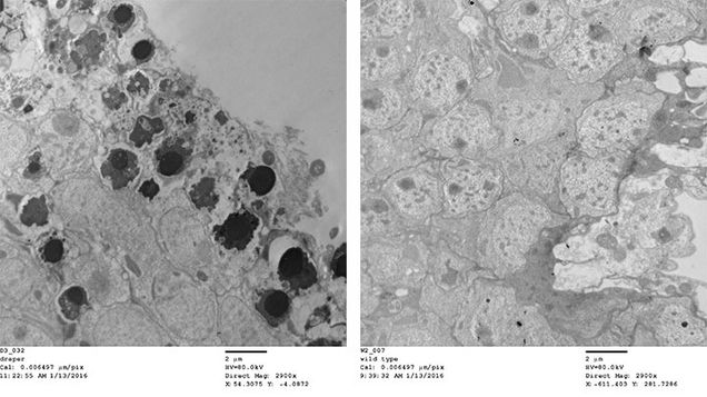 electron micrographs of normal brain tissue and brain tissue from a mutant that can’t clear the dead cells