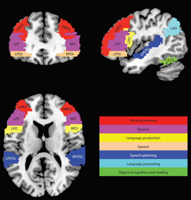 Brain image depicting: Working memory, speech, language production, speech planning, language processing, object recognition and reading