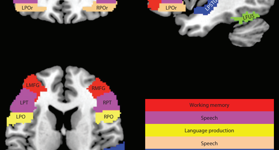 Brain image depicting: Working memory, speech, language production, speech planning, language processing, object recognition and reading