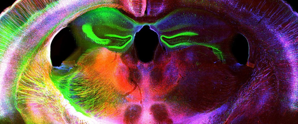 stained cross section of a brain