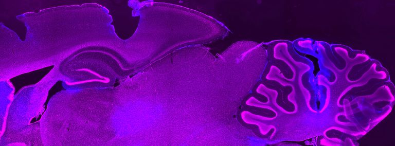 stained cross section of a brain