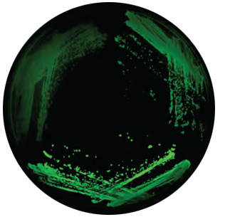 In this experiment, yTRAP produced a stronger fluorescent green signal when the cell had fewer prions. Three cell types were tested and produced varying signal strength depending on their prion state. The brightest green signaled no prions were present (bottom), a slightly dimmer green showed a weak presence of prions (top right) and an even dimmer green signal for a strong prion presence (top left). Image provided by Assistant Professor Ahmad S. Khalil