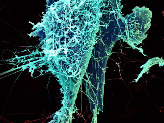 ebola virus particles, ebola hemorrhagic fever, ebola virus disease, ebola virus microscopic image