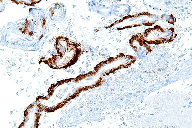 Amyloid-beta protein