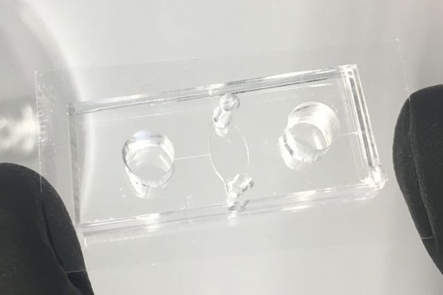 The blood vessel on the chip