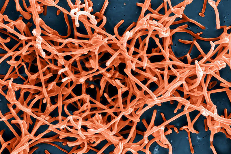 microscopic image of ebola virus