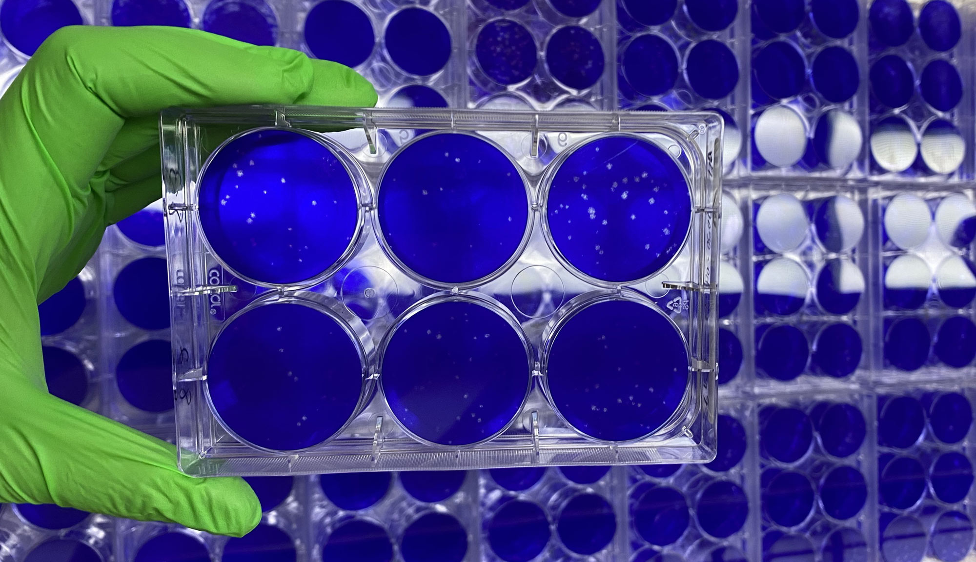 nanosponges containing fragments of lung cell membranes in a cell culture in a NEIDL laboratory