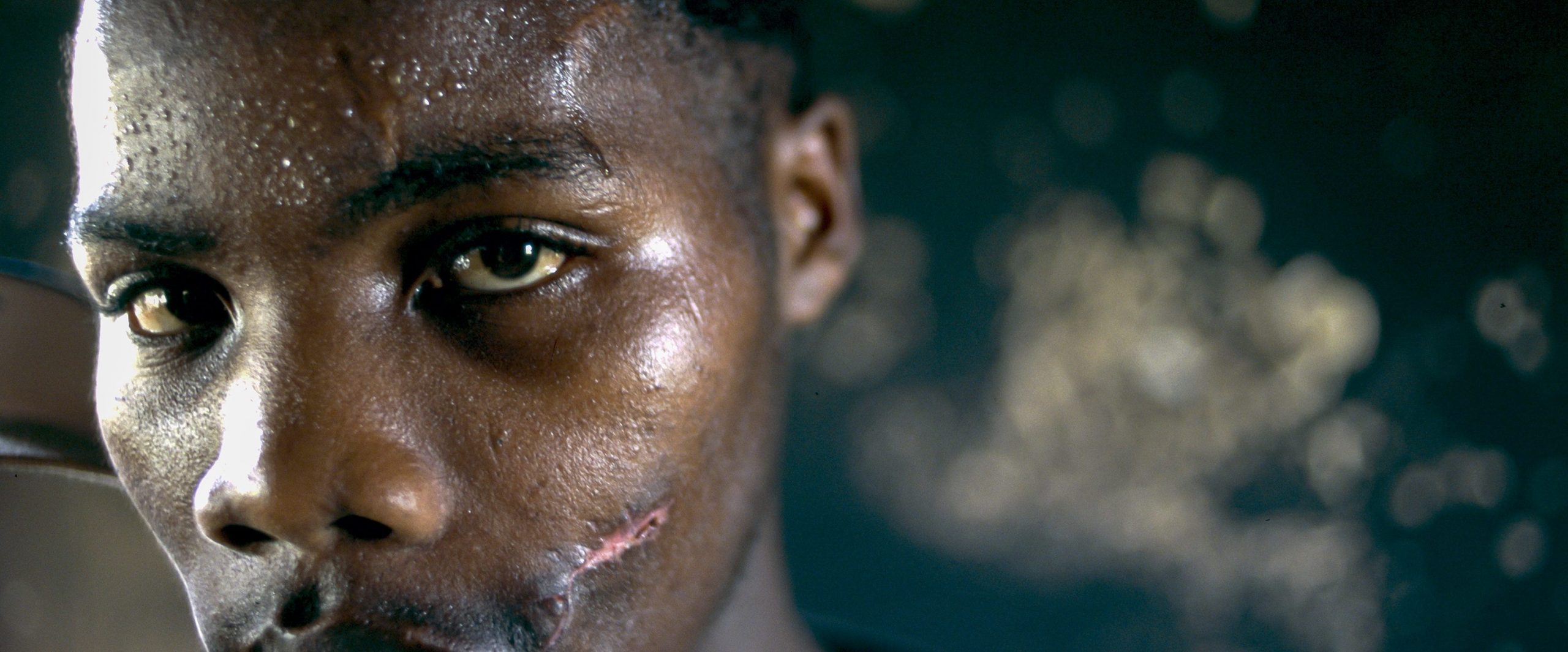 A 1996 portrait of an African National Congress supporter who was shot in the face and had his home burned the year before.