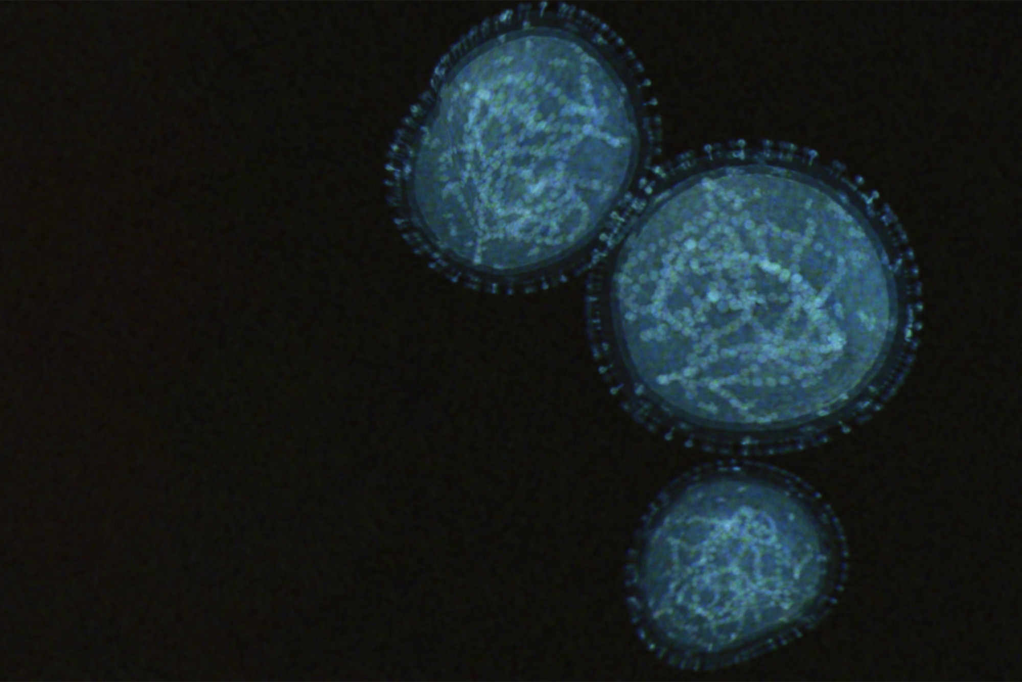 A microscope image of the monkeypox virus, showing small cells with a blue hue