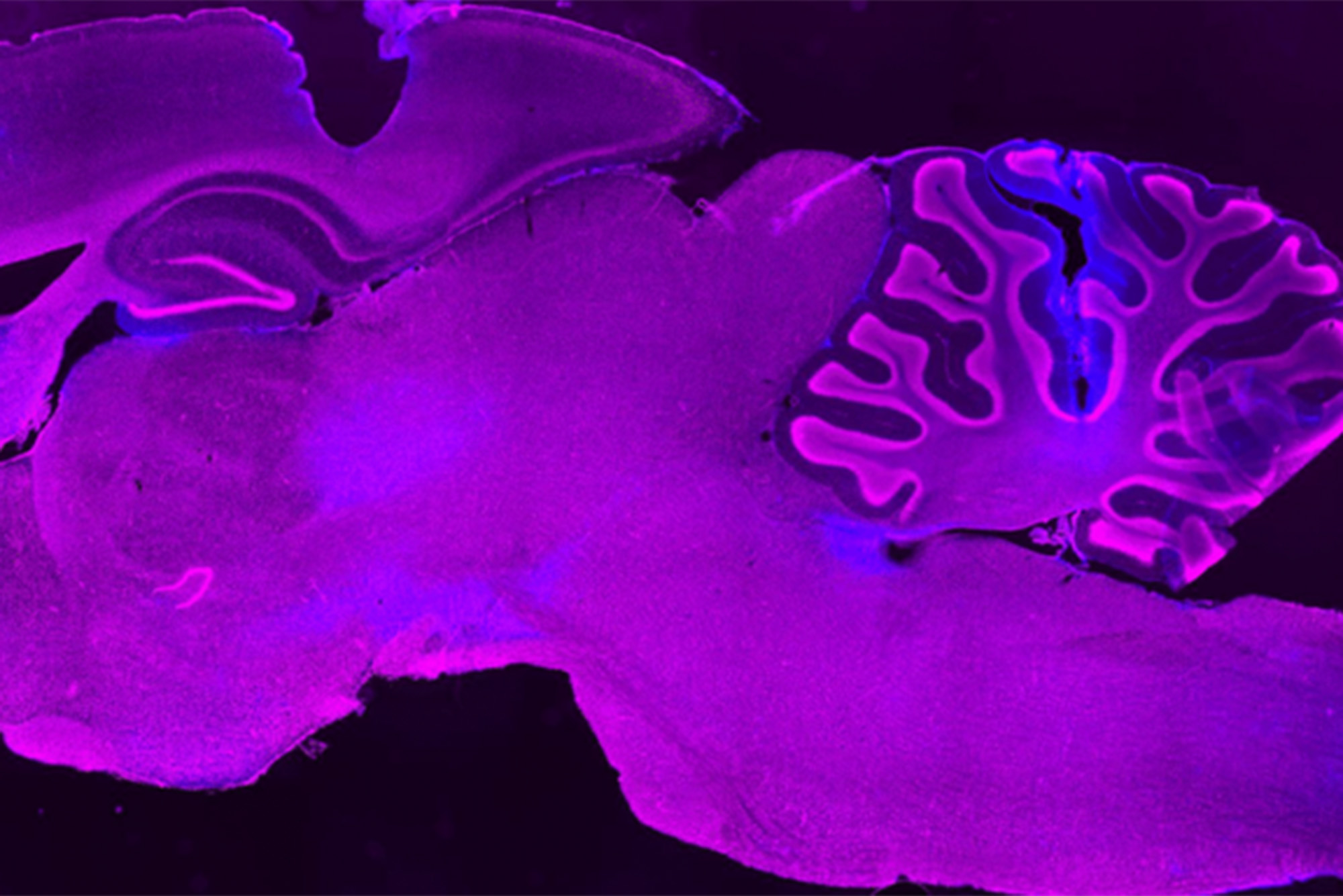 Photo: A cross section of a rat brain that is vibrant purple with blue highlights