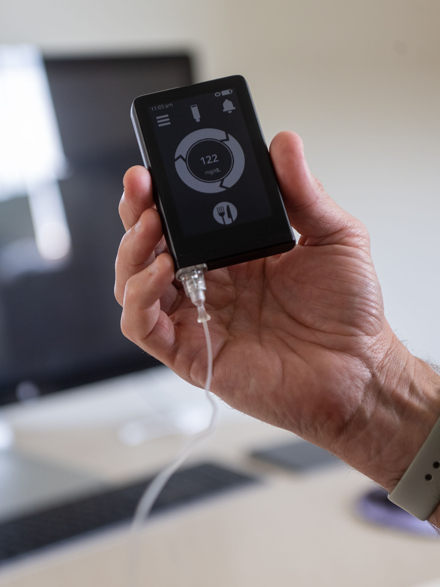 Image: Photo of The iLet bionic pancreas, which automatically monitors blood glucose levels and delivers tailored insulin doses. A hand displays a small black device with gold details and display with gold buttons. Display shows the blood glucose reading and has a symbol of food on it. Text on image reads "CAUTION: The iLet bionic pancreas is an investigational device, limited by federal (or United states) law to investigational use."