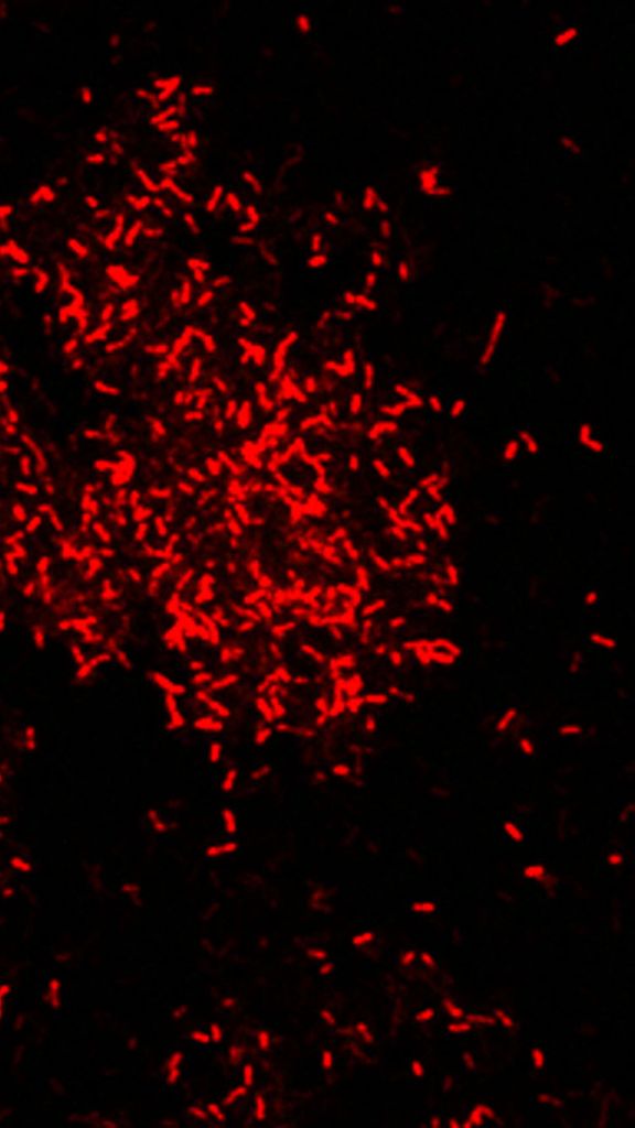 Photo: Microbes under a microscope, they appear as red and scattered