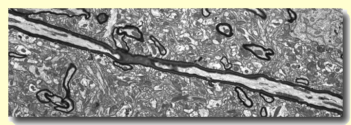 Axon