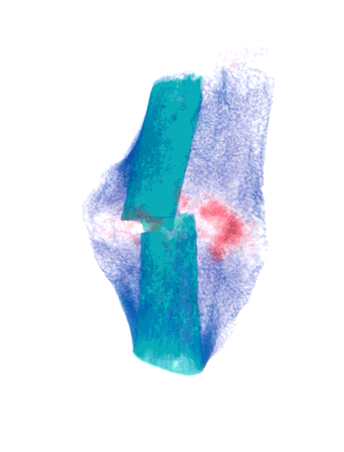 Bone-Rotation