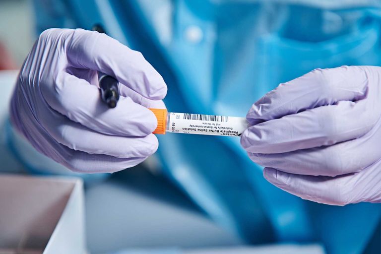 A person wearing gloves holds a specimen tube and a black marker.