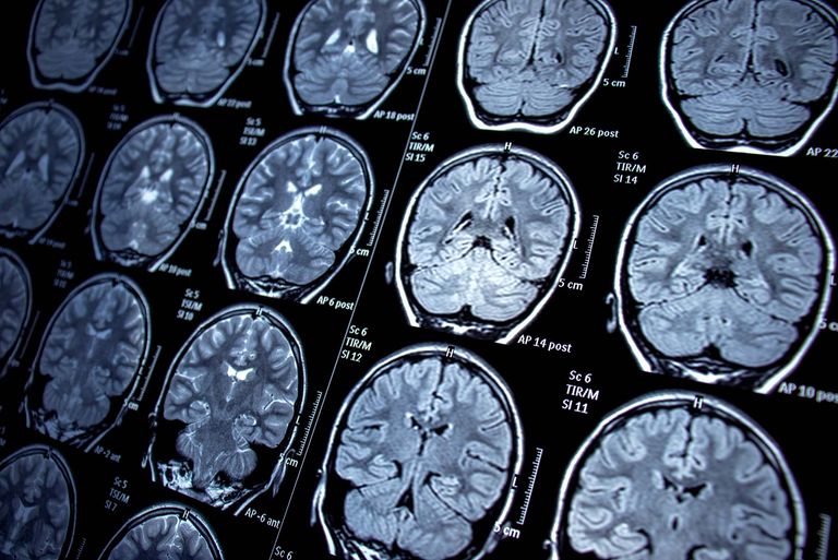 Brain scans