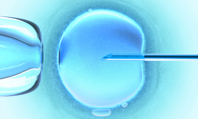 in-vetro-fertilization