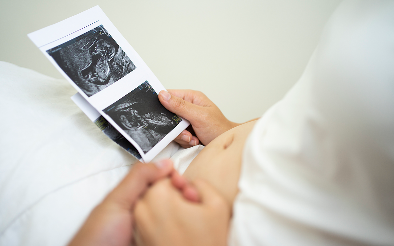 Young couple holding hands viewing ultrasound of baby