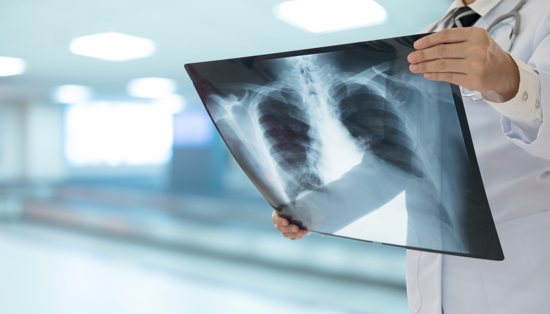 Doctor radiology looking chest or lung x-ray image to diagnose pneumonia or inflamed lungs. medical checkup concept.